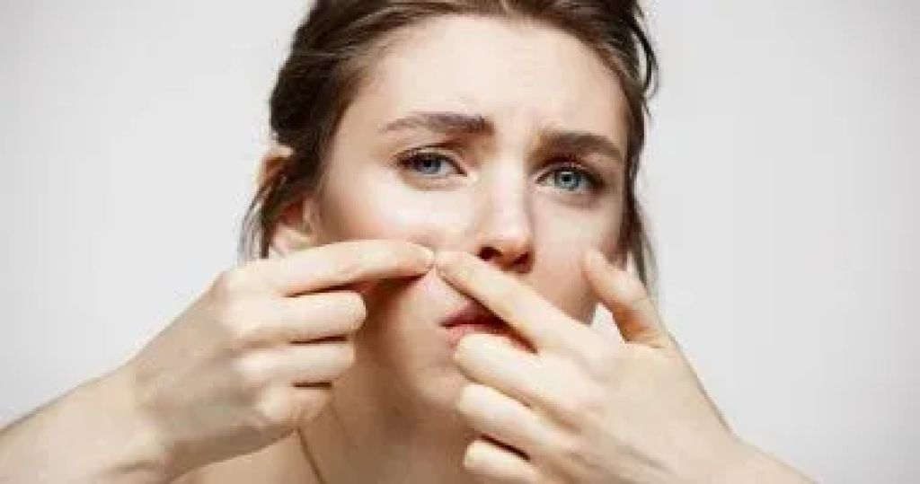 وصفات طبيعية للتخلص من البثور قبل مناسباتك المهمة.. الثوم كلمة السر